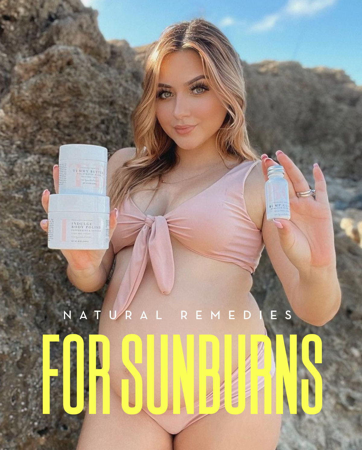 Sunburn Relief - Natural Remedies
